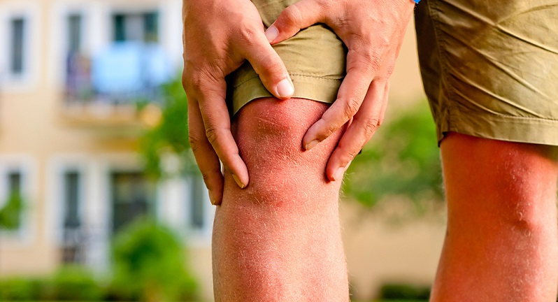 симптомы липоартрита коленного сустава на фото